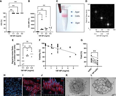 Fluorine labelling of therapeutic human tolerogenic dendritic cells for 19F-magnetic resonance imaging